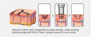 Bạn Đã Hiểu Nguyên Lý Và Bảo Vệ Của Xóa Xăm Bằng Laser?